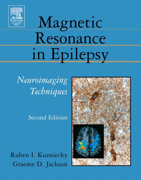Magnetic Resonance in Epilepsy: Neuroimaging Techniques