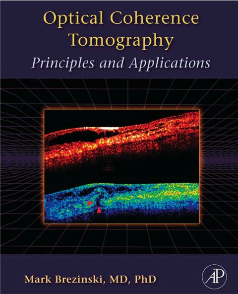 Optical Coherence Tomography: Principles and Applications