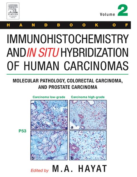 Handbook of Immunohistochemistry and in Situ Hybridization of Human Carcinomas: Molecular Pathology, Colorectal Carcinoma, and Prostate Carcinoma